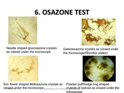 osazone test|results for carbohydrate tests.